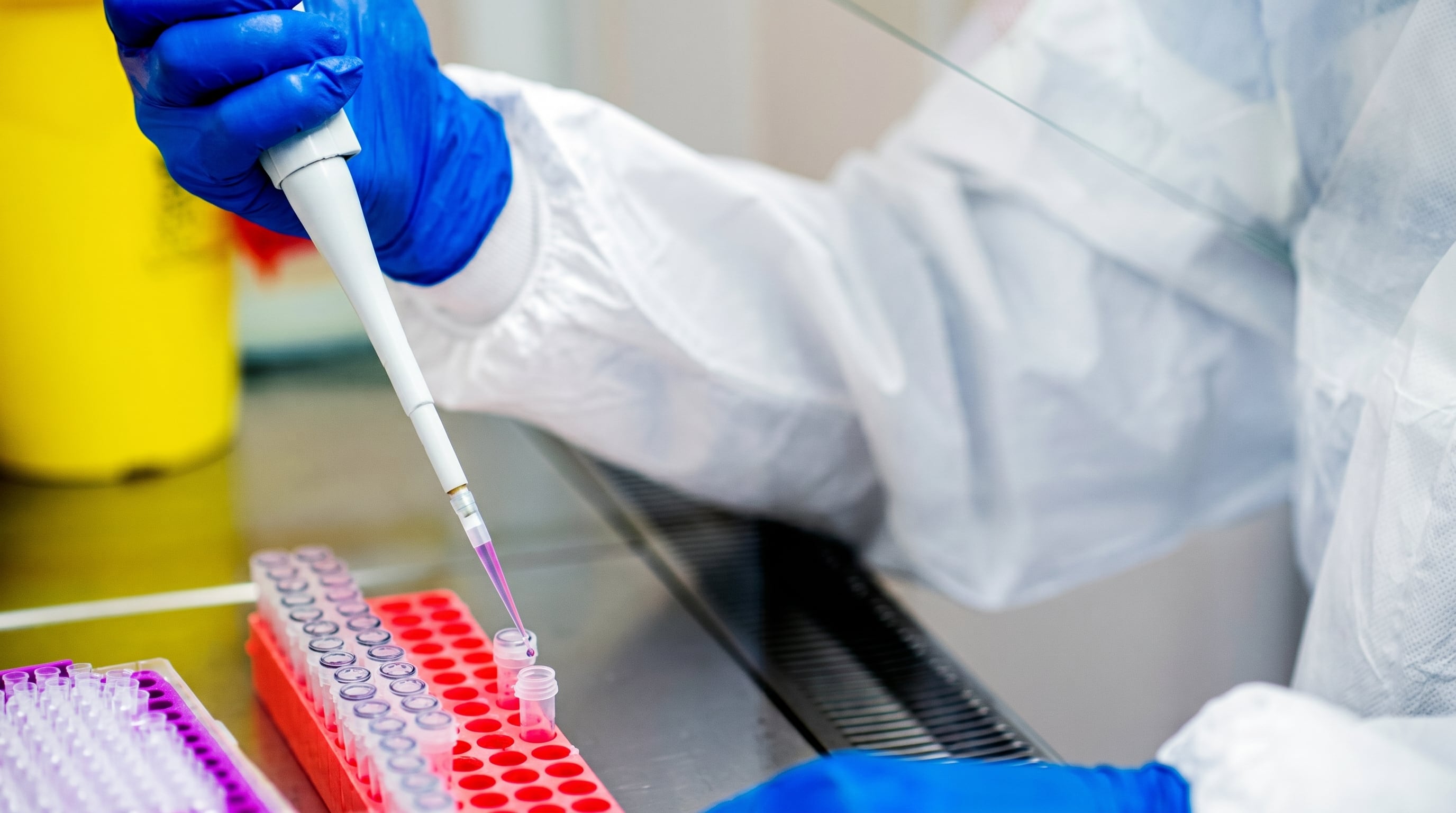 Personal de laboratorio prepara muestras para investigaciones sobre inmunoterapia del cáncer. (Imagen Ilustrativa Infobae)