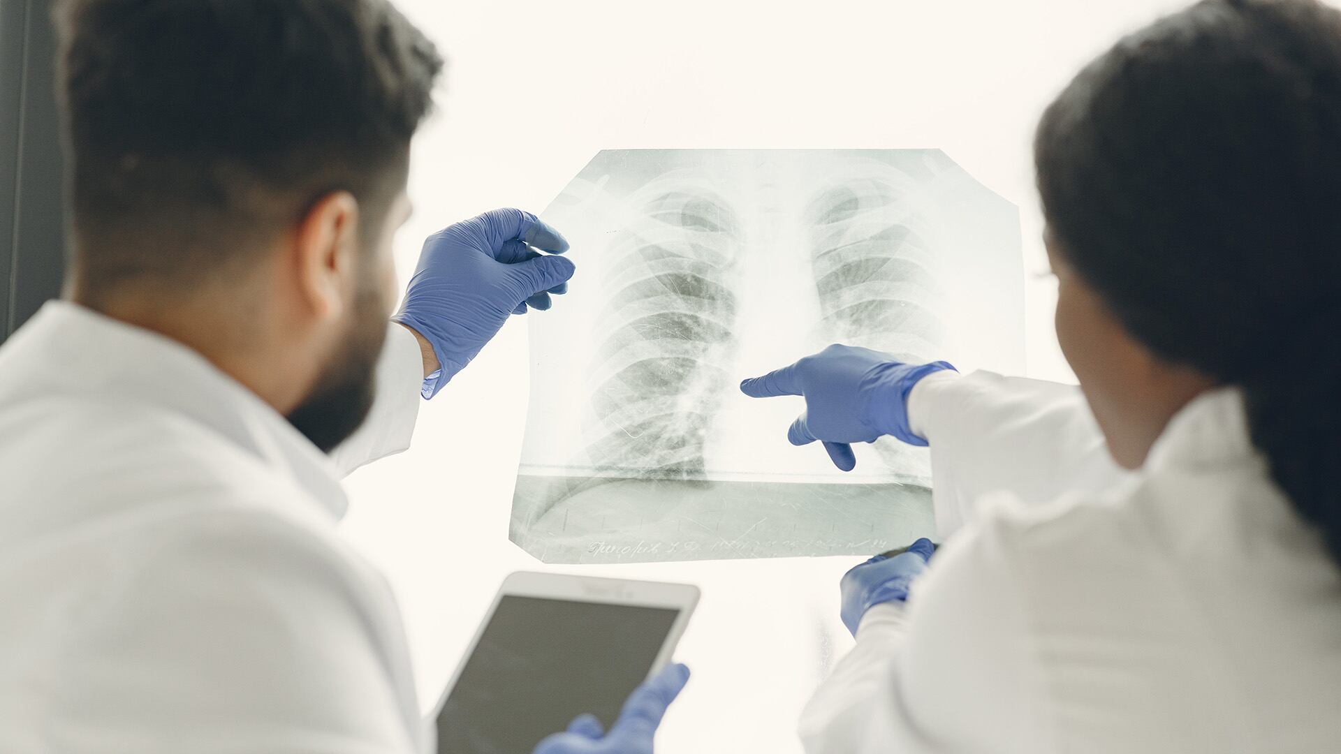 El tabaquismo pasivo, el radón, el asbesto y la contaminación del aire figuran entre los principales riesgos ambientales para el cáncer de pulmón en no fumadores (Freepik)