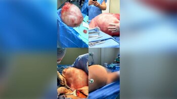 El equipo médico del hospital