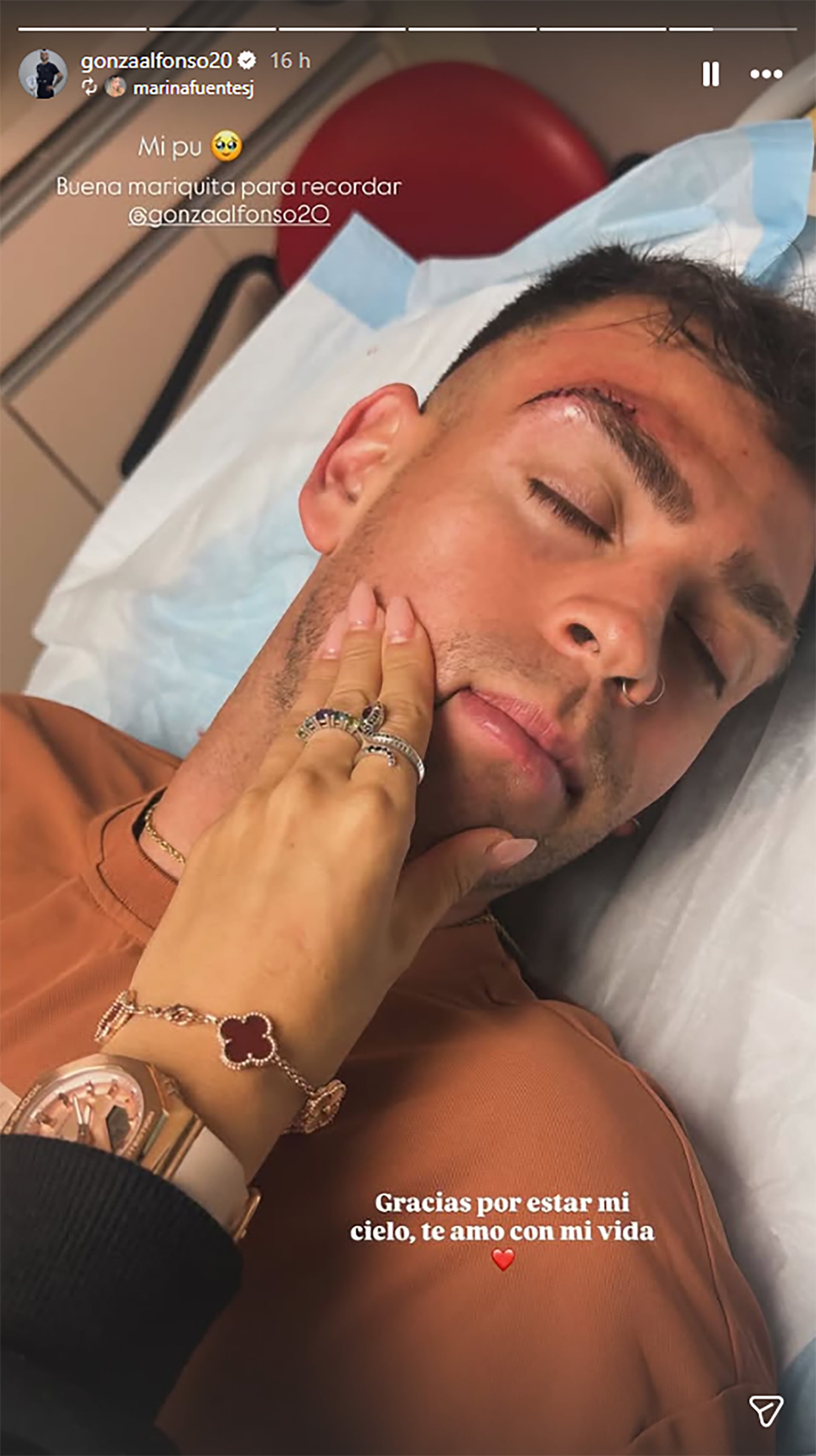 Marina Fuentes acompañó a Gonza Alfonso, quien se recupera de una lesión con puntos de sutura visibles en su ceja.