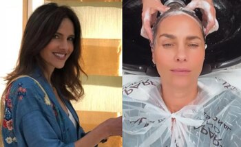 Así quedó Paola Turbay después de accidente: “Se me fritó el pelo” - Infobae