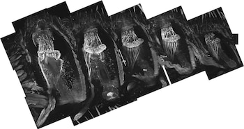 Cinco folículos de bigotes en