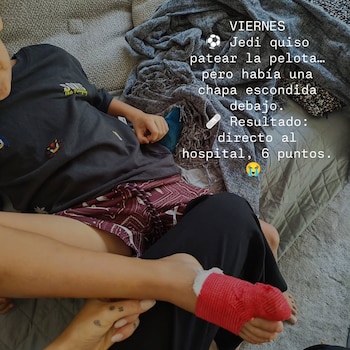 Lorelei Tarón contó en redes sociales el accidente doméstico que sufrió Jedidiah mientras jugaba con una pelota - crédito @loreleitaron/ Instagram