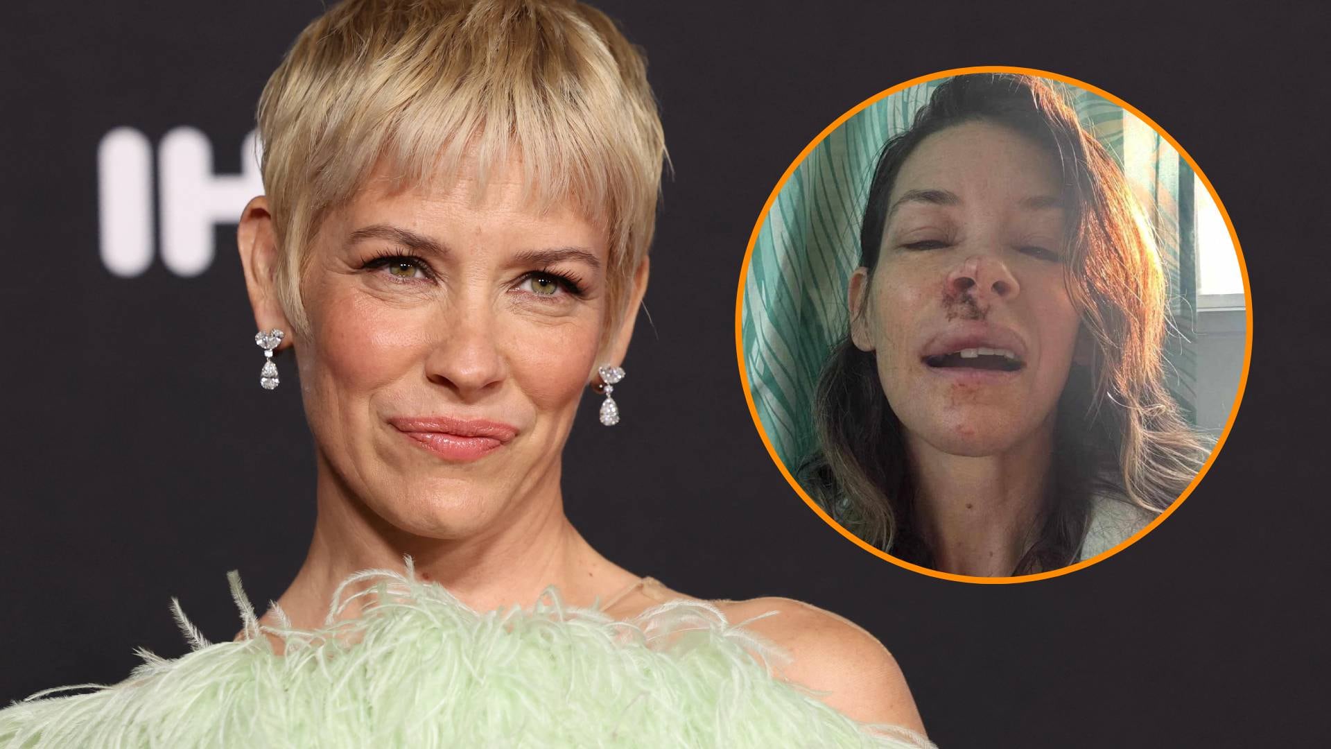 Evangeline Lilly reveló el diagnóstico de daño cerebral tras su accidente en una playa de Hawái en 2025 (REUTERS/Instagram/@evangelinelillyofficial)