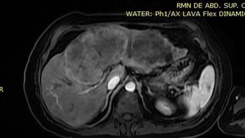 El procedimiento, dirigido por un