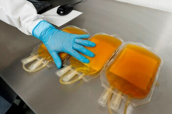 Se administró plasma de convalecencia