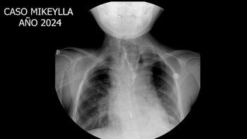 La pequeña tendrá una vida