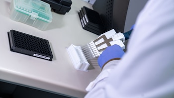El estudio de biomarcadores en sangre se indica para pacientes con trastornos cognitivos y no está recomendado para personas sanas y asintomáticas (Fleni)
