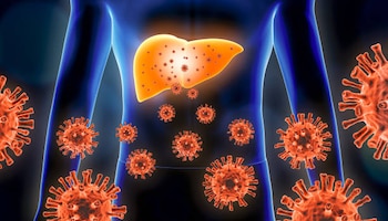 Existen diferentes causas de esta enfermedad, aunque el contagio por virus es de las más conocidas. Foto: (iStock)