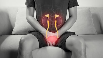 Cáncer de vejiga: los cinco