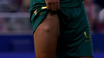 Los extraños bultos en la