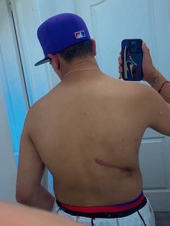 Medina tuvo que ser sometido