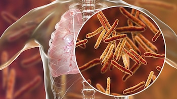 Europa no detecta uno de