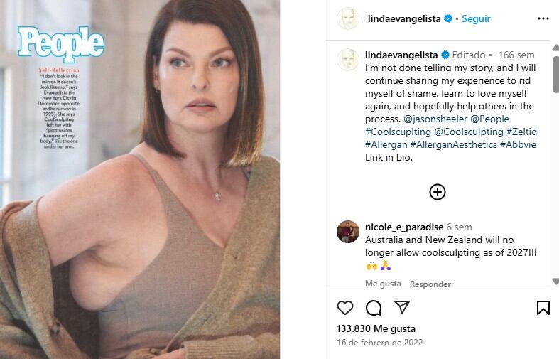 Como resultado del CoolSculpting, su cuerpo desarrolló bultos duros y dolorosos en distintas zonas, impidiéndole moverse con libertad (PEOPLE, vía Instagram/@lindaevangelista)