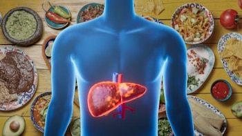 ¿Cuál es el mejor platillo