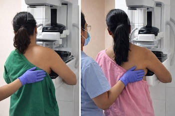 Díptico: dos mujeres, vistas de espaldas, siendo asistidas por personal médico durante una mamografía en un hospital.