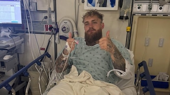 Jake Paul fue operado de