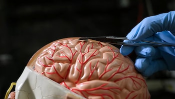 Llegó competencia a Neuralink de