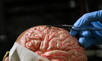 El innovador sistema BISC se