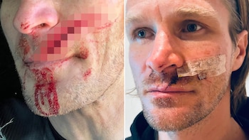 La impactante herida que le