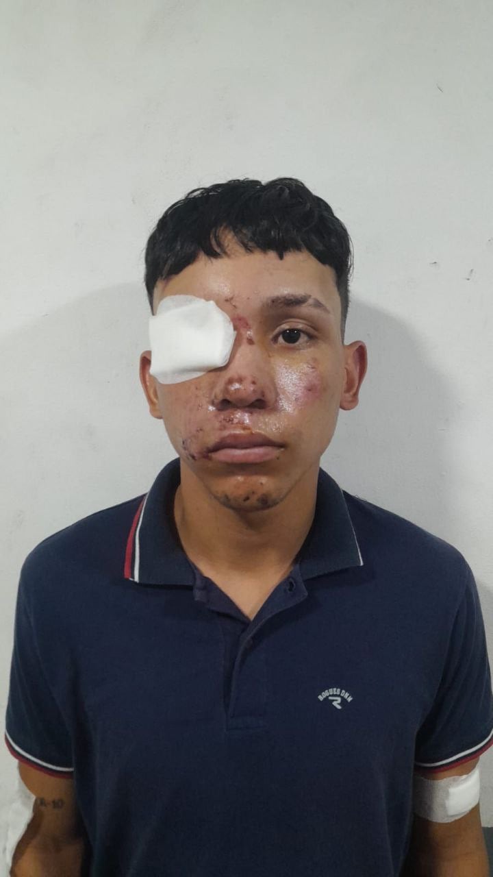 Alias TatA usó la identidad de su hermano para intentar evadir a las autoridades tras accidentarse en una carrera ilegal de motos en Barranquilla - crédito @enterate_0812/X