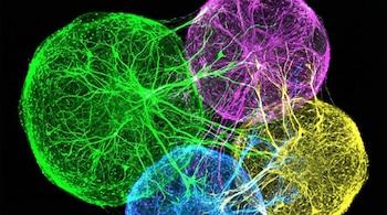 Cuatro esferas de tejido, una verde, una magenta, una amarilla y una azul, interconectadas por intrincadas redes neuronales brillantes, sobre un fondo negro.