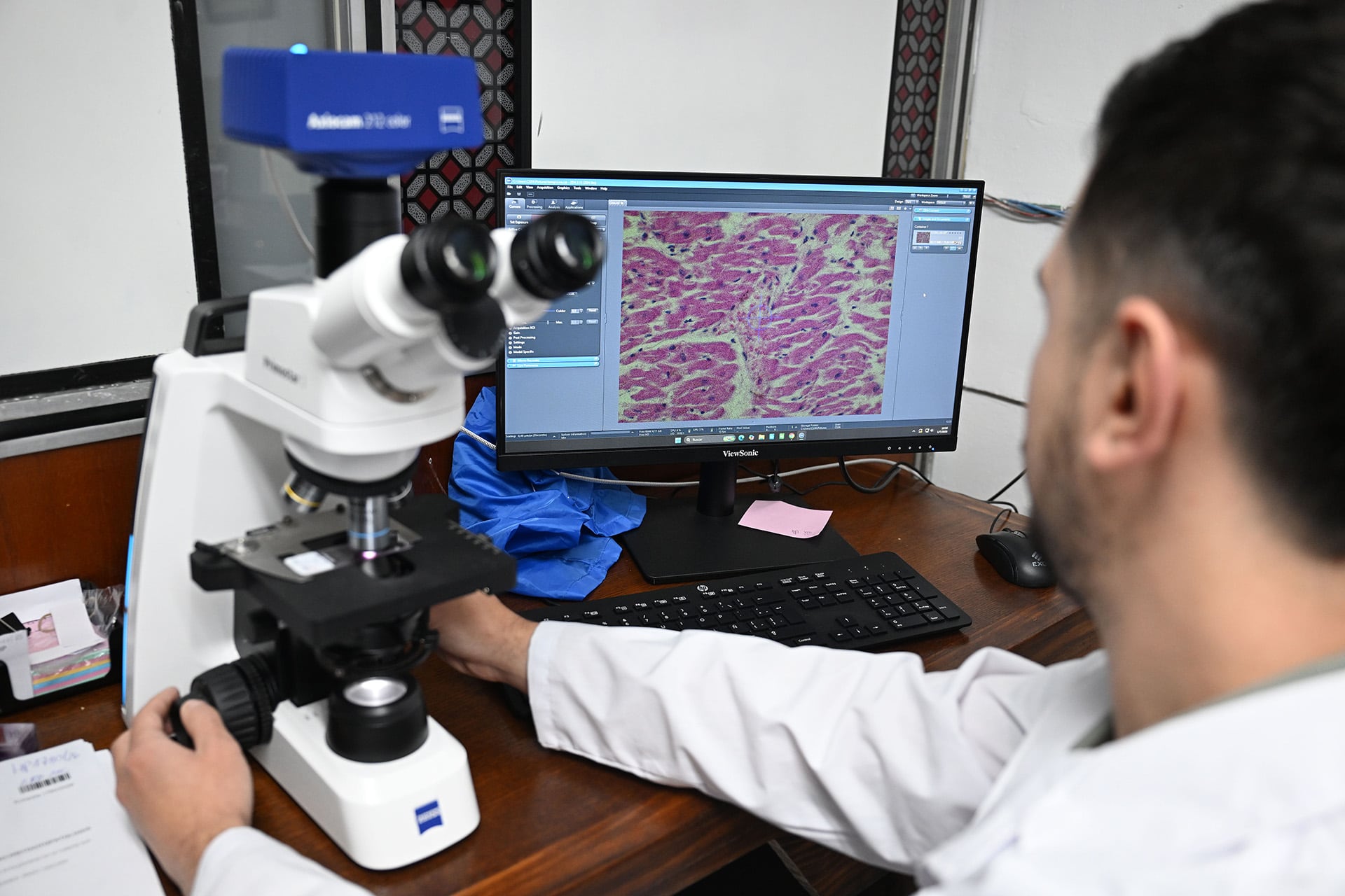 El analisis de una muestra de cerebro vista en un microscopio del área de histopatología