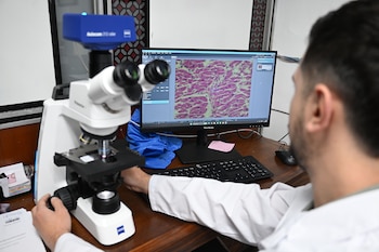 El analisis de una muestra de cerebro vista en un microscopio del área de histopatología