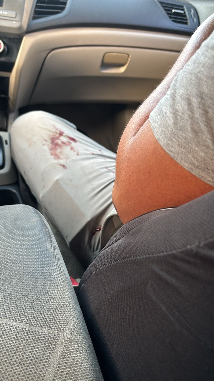 Estudiante de medicina resulta herido tras ataques con artefactos explosivos desde el interior del campus central durante protestas contra el rector Walter Mazariegos. (Cortesía)
