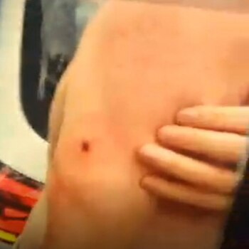 Así quedó herido R.J.A.