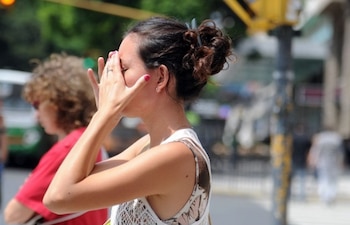 La exposición excesiva al sol,