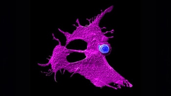 Imagen microscópica que muestra una