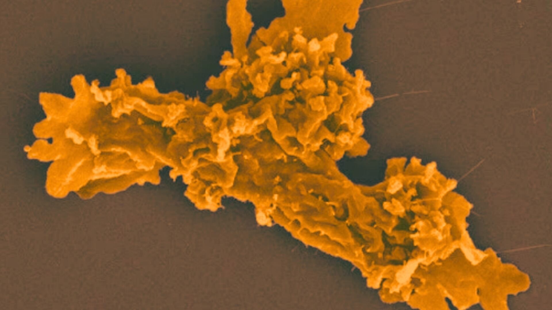 La especie de ameba descrita es capaz de formar quistes resistentes a 70 grados de temperatura (Rappaport BioRxiv)