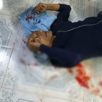 El periodista fue apuñalado por