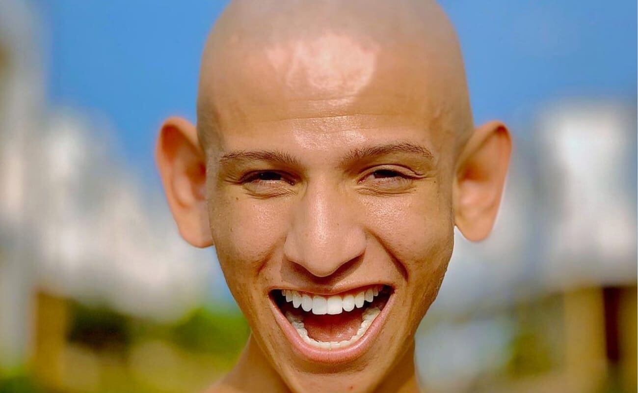 La Liendra no quiso operarse el rostro y las orejas por amor propio - crédito @La_Liendraa/Instagram