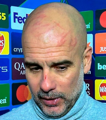 Los arañazos de Guardiola en