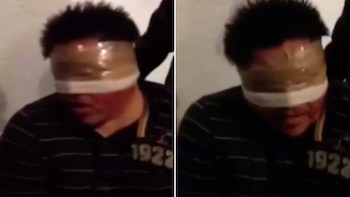 Tortura contra Carlos Canto Salgado