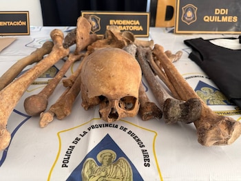 Un cráneo, tibias, fémures y