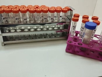 Identificación de seis taxones de parásitos revela condiciones propicias para la transmisión de enfermedades. Difusión