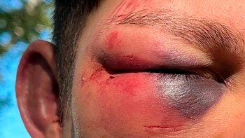 La víctima fue atacada a