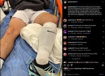 Gian Piero Díaz sufre grave