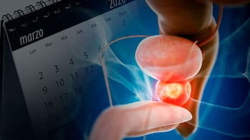 La incidencia de cáncer de