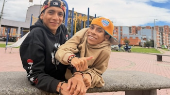 Murieron los conocidos siameses de Ecuador: los hermanos, que vivieron 27 años unidos por el tórax, fallecieron en Colombia mientras esperaban una intervención