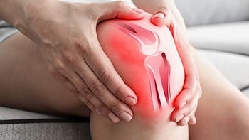 La radioterapia en dosis bajas podría ayudar a reducir la artritis de rodilla
