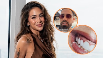 Odontólogo lanzó alerta sobre la salud dental de Greeicy Rendón: “Tiene una infección”