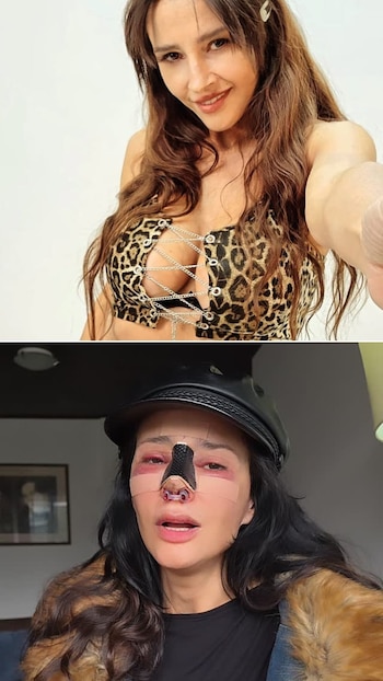 Antes y después de Dorismar.