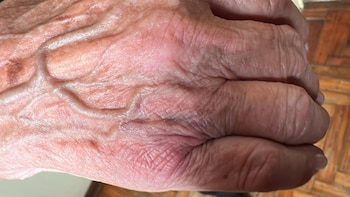 Las manos golpeadas de María