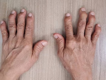 Los factores de riesgo de