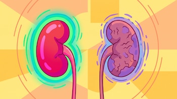 5 hábitos nutricionales recomendados por una dietista para la enfermedad renal crónica