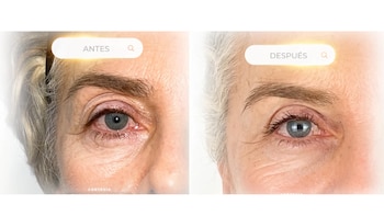 El cirujano que atendió a Margarita Rosa de Francisco explicó el enfoque del procedimiento y mostró el antes y el después del procedimiento - crédito @alangonzalezmd @margaritarosa.defrancisco/ Instagram